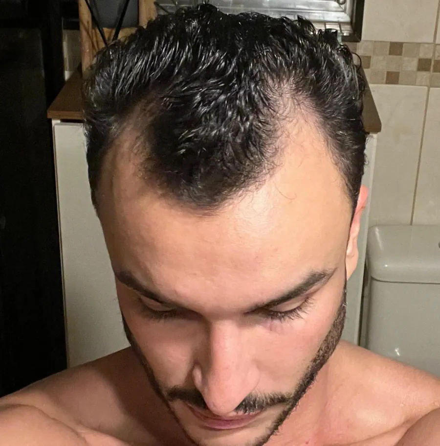 Antes