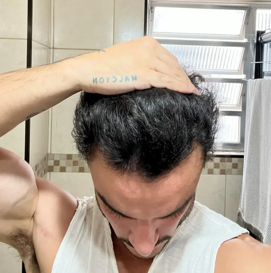 Depois