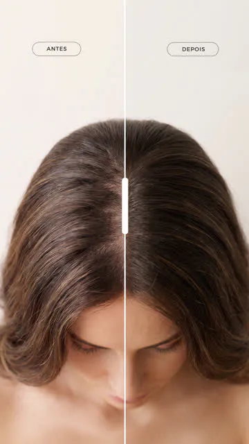 Antes e depois do uso do Cronograma Force Hair